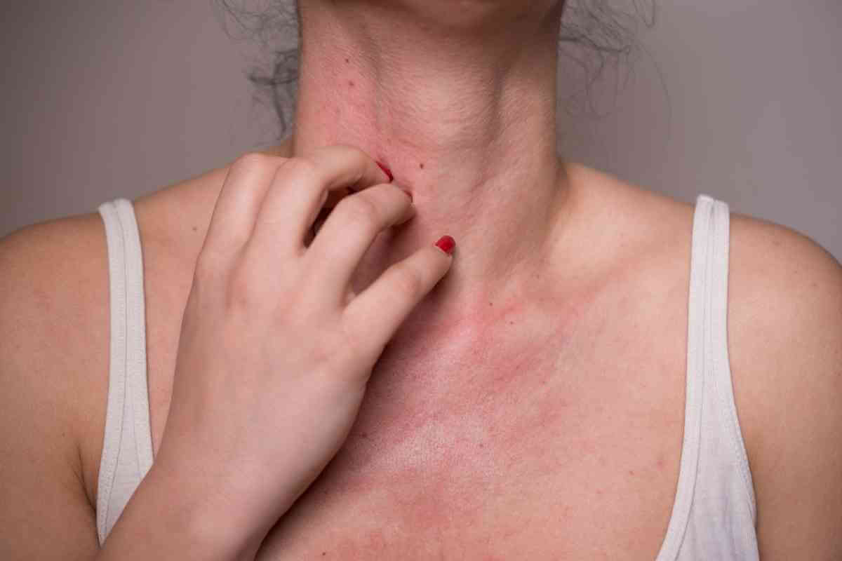 quais-as-alergias-trataveis (1)